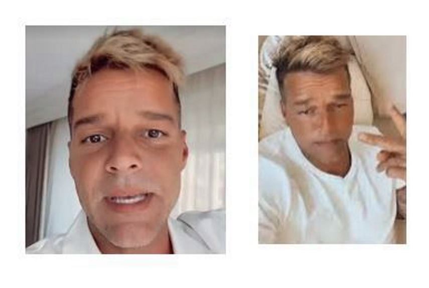 Ricky Martin y la polémica sobre una cirugía facial